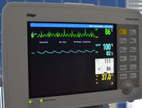 EKG